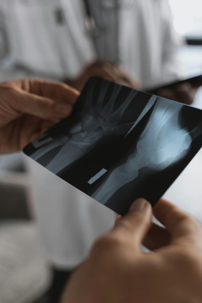 pexels-photo-5452281-5452281 Close-up of hands holding an X-ray image in a medical environment with healthcare professionals.